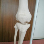 骨模型の膝関節を前から見たところ